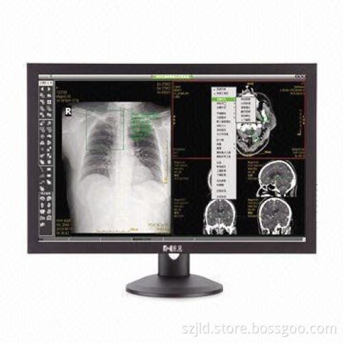 30-inch Medical Monitor